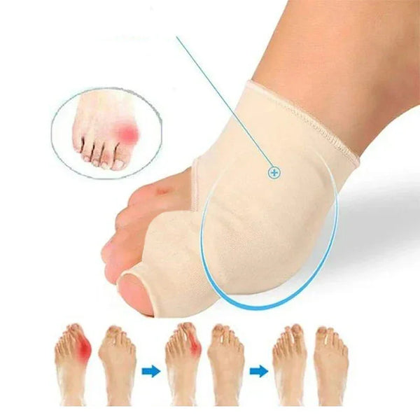 Corretor de Joanete – Conforto e Suporte para Seus Pés