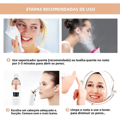 Máquina Removedora de Cravos por Sucção - USB - 3 Níveis Potência